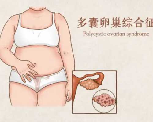 国内申请供卵,高龄女性做试管婴儿*率高吗？试管婴儿的费用是多少钱